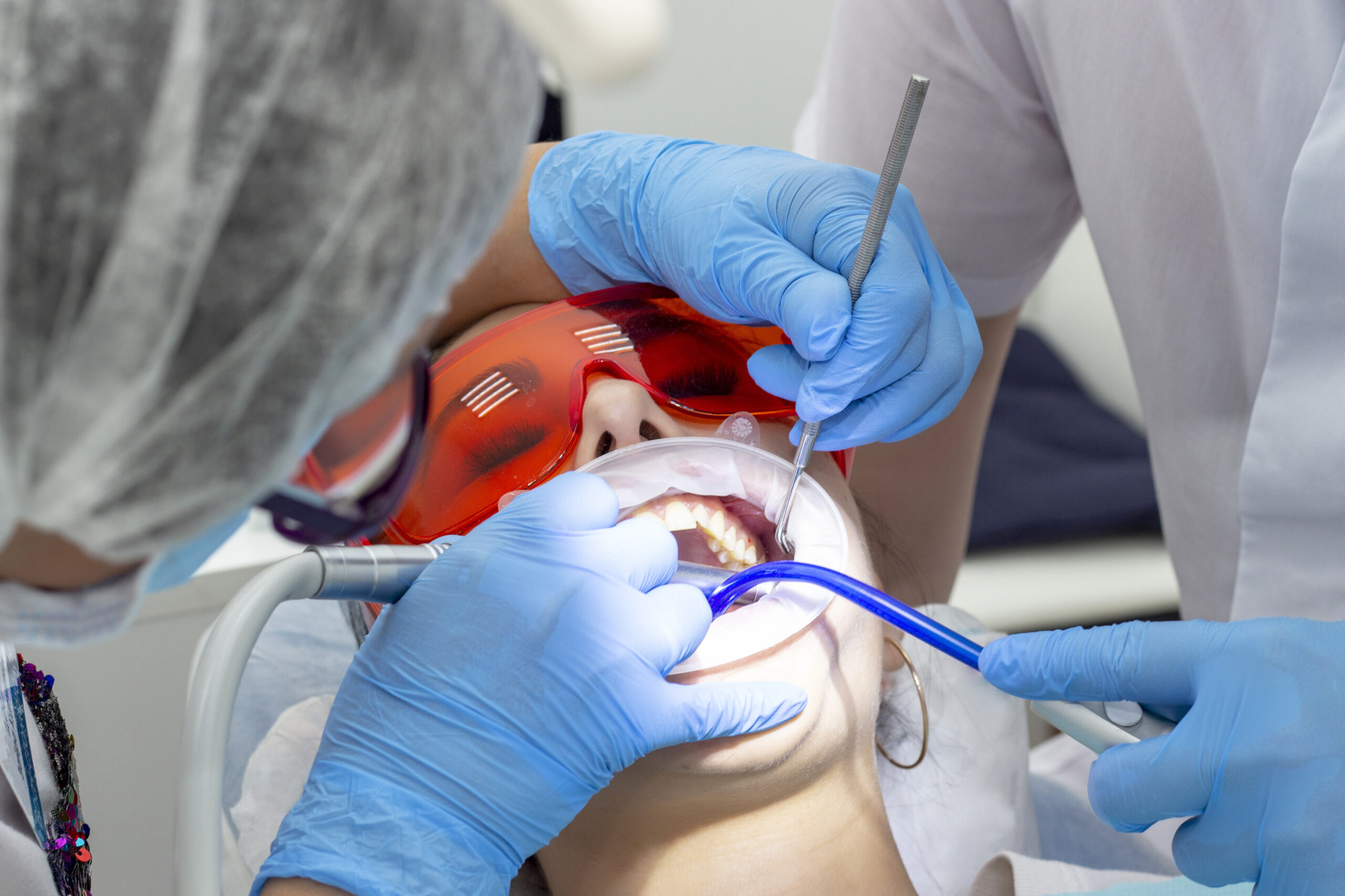 Root Canal Treatment in Trivandrum